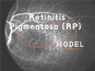Retinitis Pigmentosa (RP) NHP-malli